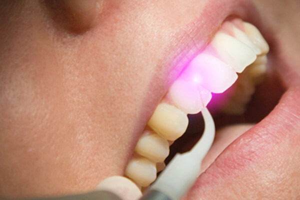 Laserbehandlung Laserchirurgie